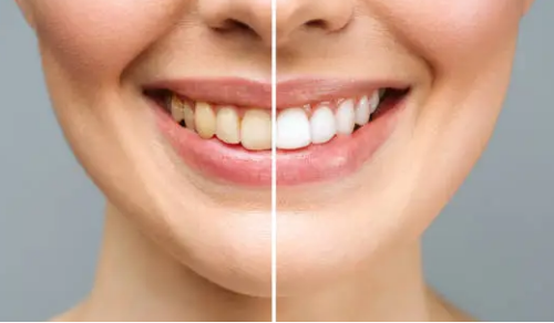 cosmetic dentist Adelaide