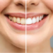 cosmetic dentist Adelaide