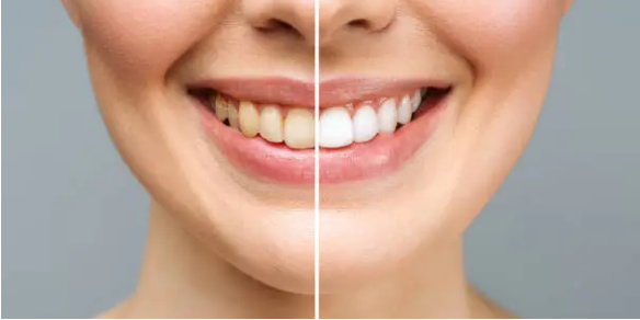 cosmetic dentist Adelaide